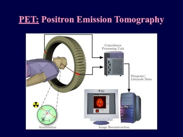 PET: Positron Emission Tomography