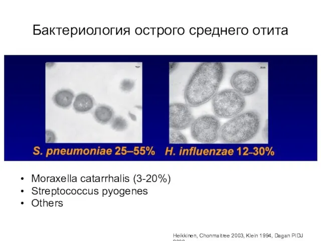 (Бактериология острого среднего отита) L.Sanders, 2008 Бактериология острого среднего отита Moraxella catarrhalis