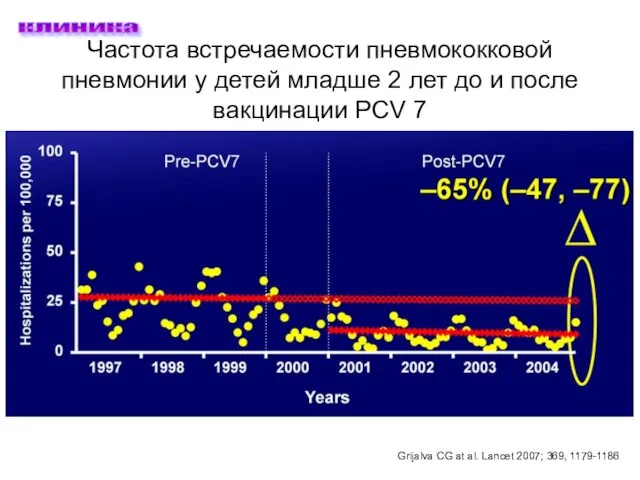 Частота встречаемости пневмококковой пневмонии у детей младше 2 лет до и после