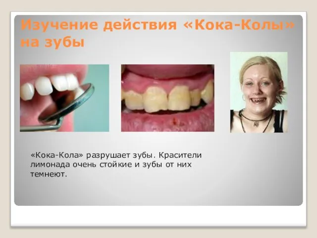 Изучение действия «Кока-Колы» на зубы «Кока-Кола» разрушает зубы. Красители лимонада очень стойкие