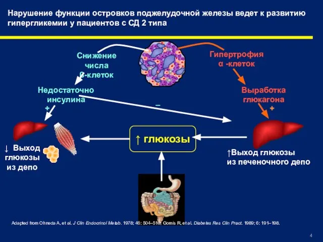 Нарушение функции островков поджелудочной железы ведет к развитию гипергликемии у пациентов с
