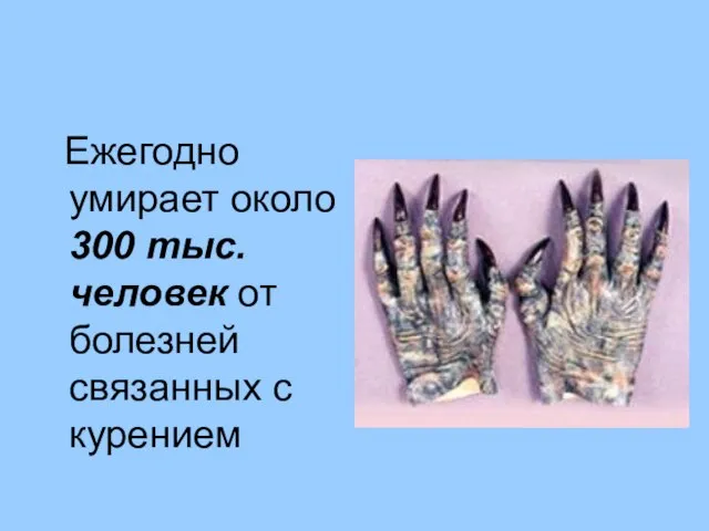 Ежегодно умирает около 300 тыс. человек от болезней связанных с курением