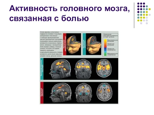 Активность головного мозга, связанная с болью