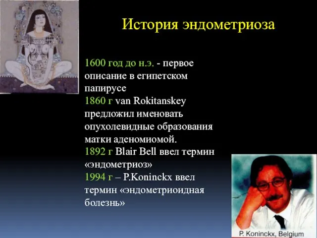 История эндометриоза 1600 год до н.э. - первое описание в египетском папирусе