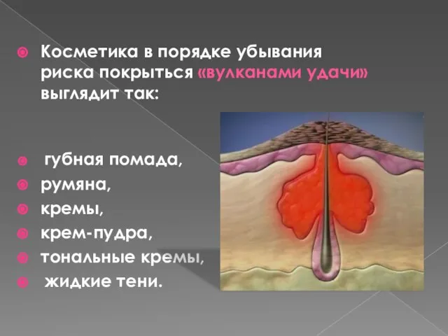 Косметика в порядке убывания риска покрыться «вулканами удачи» выглядит так: губная помада,