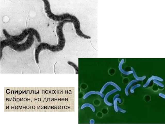 Спириллы похожи на вибрион, но длиннее и немного извивается