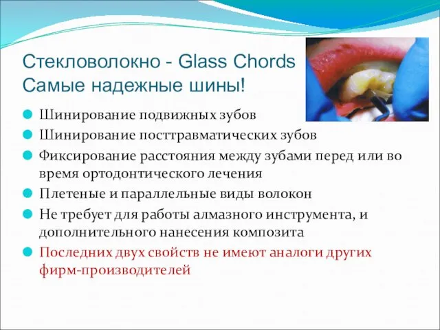 Стекловолокно - Glass Chords Самые надежные шины! Шинирование подвижных зубов Шинирование посттравматических