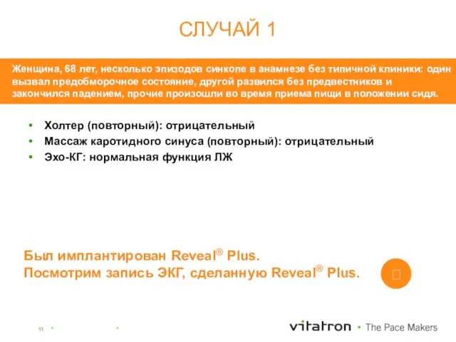 Холтер (повторный): отрицательный Массаж каротидного синуса (повторный): отрицательный Эхо-КГ: нормальная функция ЛЖ