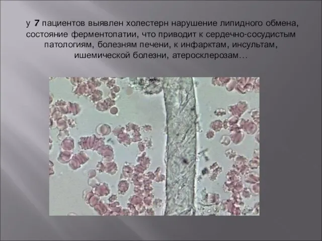 у 7 пациентов выявлен холестерн нарушение липидного обмена, состояние ферментопатии, что приводит