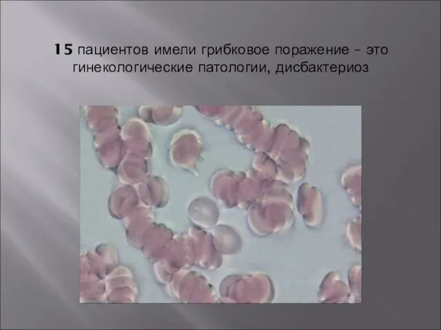 15 пациентов имели грибковое поражение – это гинекологические патологии, дисбактериоз