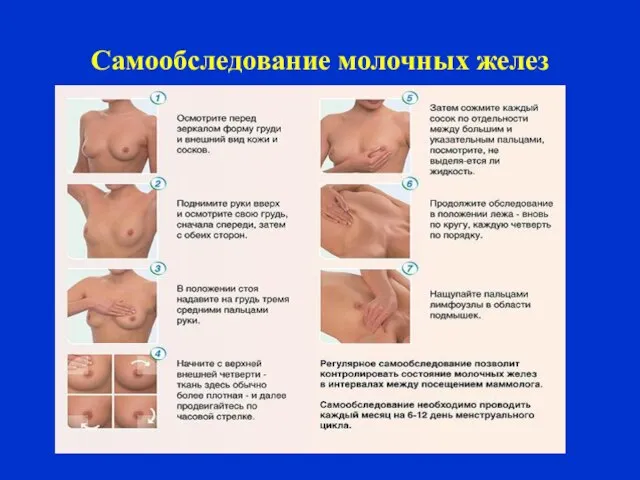 Самообследование молочных желез