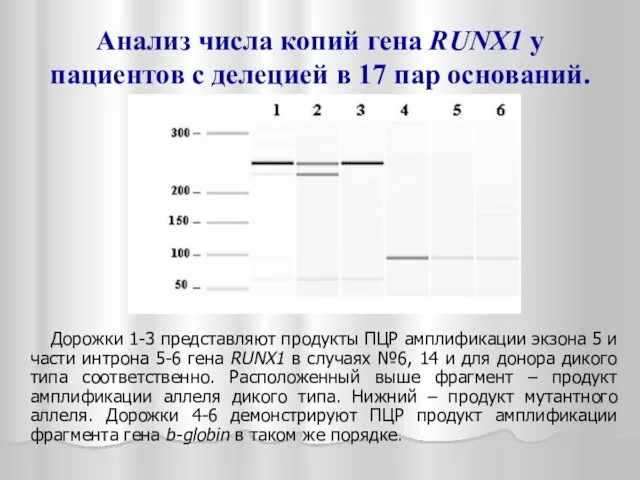 Анализ числа копий гена RUNX1 у пациентов с делецией в 17 пар