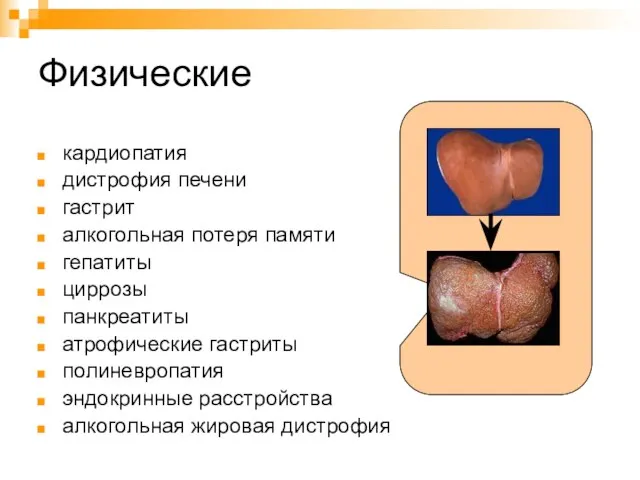 Физические кардиопатия дистрофия печени гастрит алкогольная потеря памяти гепатиты циррозы панкреатиты атрофические