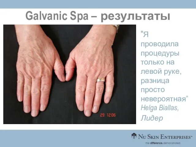 Galvanic Spa – результаты "Я проводила процедуры только на левой руке, разница