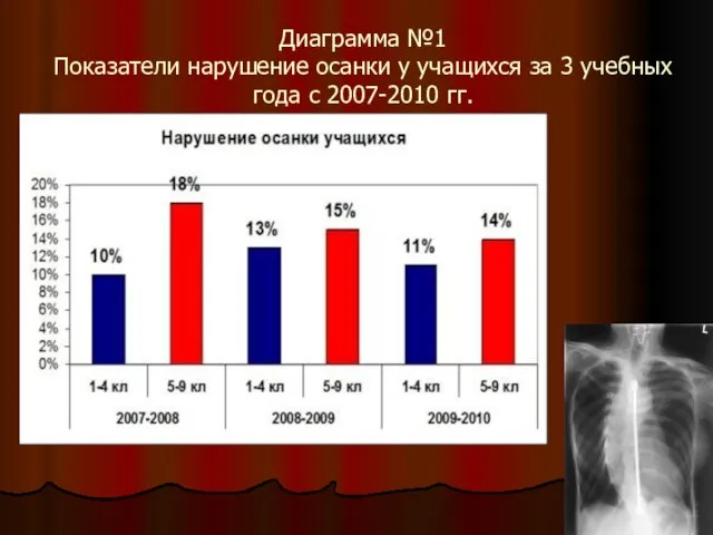 Диаграмма №1 Показатели нарушение осанки у учащихся за 3 учебных года с 2007-2010 гг.