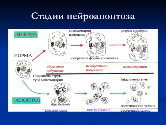 Стадии нейроапоптоза