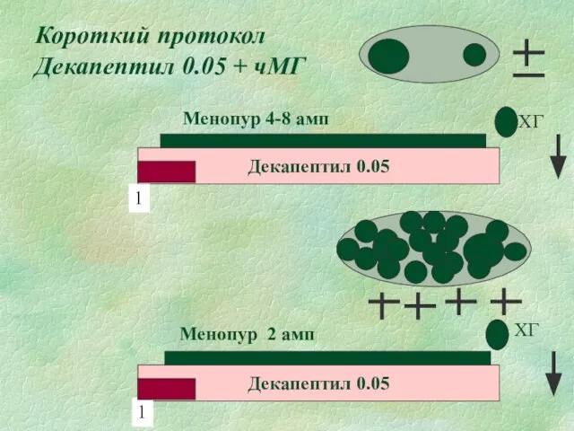 Короткий протокол Декапептил 0.05 + чМГ Декапептил 0.05 Менопур 2 амп ХГ