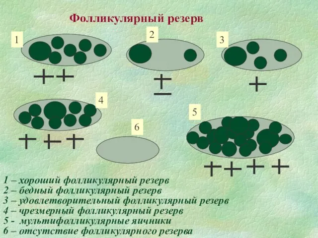 Фолликулярный резерв 1 2 3 4 5 6 1 – хороший фолликулярный