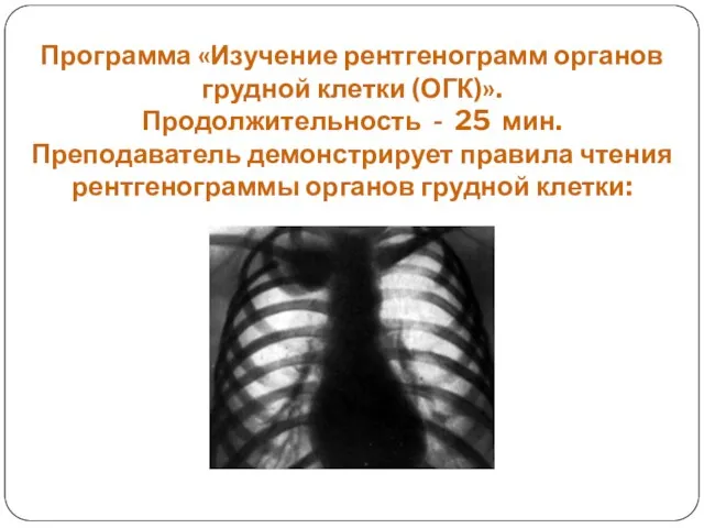 Программа «Изучение рентгенограмм органов грудной клетки (ОГК)». Продолжительность - 25 мин. Преподаватель