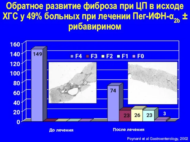 Poynard et al Gastroenterology, 2002 До лечения После лечения 3 Обратное развитие