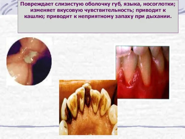 Повреждает слизистую оболочку губ, языка, носоглотки; изменяет вкусовую чувствительность; приводит к кашлю;