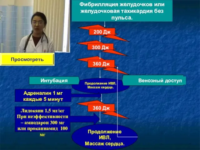 Фибрилляция желудочков или желудочковая тахикардия без пульса. Продолжение ИВЛ, Массаж сердца. Интубация