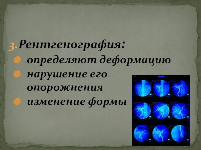 3.Рентгенография: определяют деформацию нарушение его опорожнения изменение формы