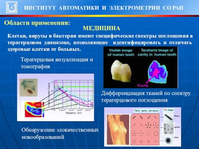 МЕДИЦИНА Терагерцовая визуализация и томография Дифференциация тканей по спектру терагерцового поглощения Обнаружение