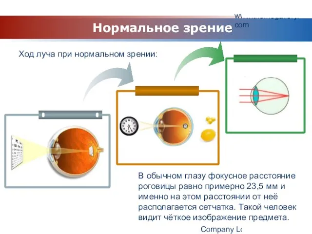 www.themegallery.com Company Logo Ход луча при нормальном зрении: Нормальное зрение В обычном