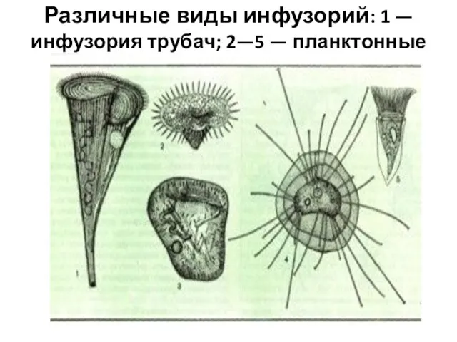 Различные виды инфузорий: 1 — инфузория трубач; 2—5 — планктонные инфузории.