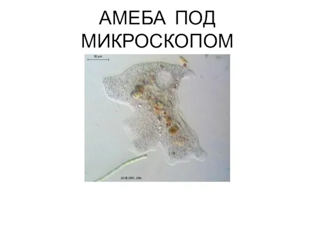 АМЕБА ПОД МИКРОСКОПОМ