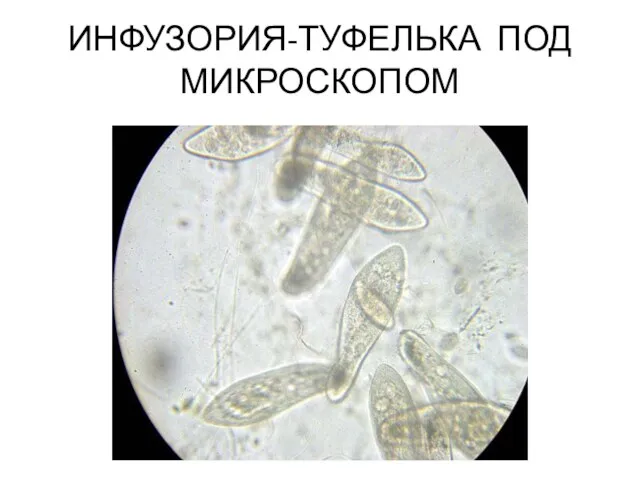 ИНФУЗОРИЯ-ТУФЕЛЬКА ПОД МИКРОСКОПОМ