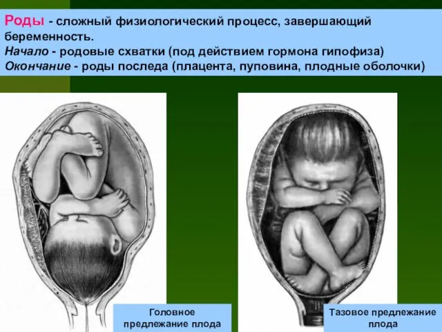 Роды - сложный физиологический процесс, завершающий беременность. Начало - родовые схватки (под