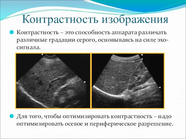 Контрастность изображения Контрастность – это способность аппарата различать различные градации серого, основываясь