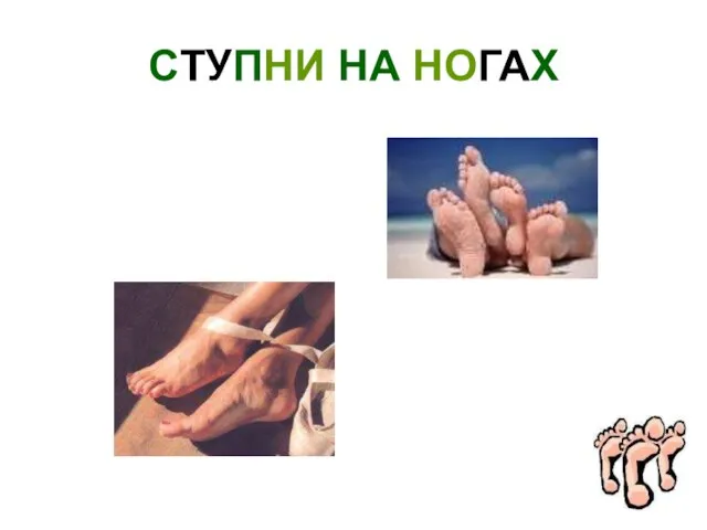 СТУПНИ НА НОГАХ