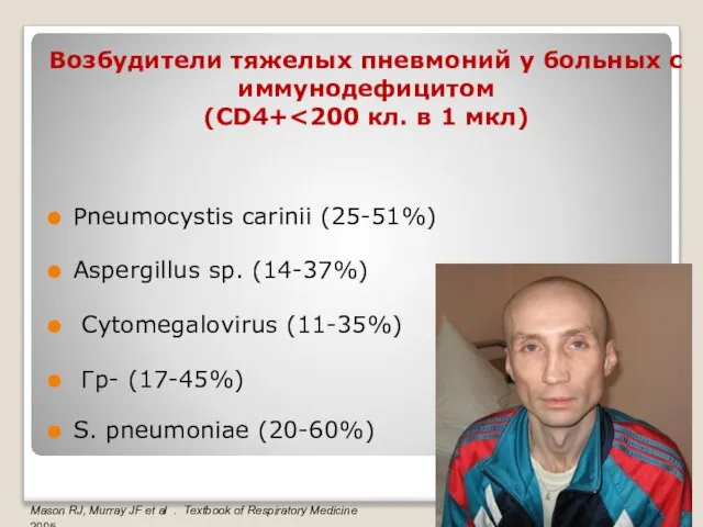 Возбудители тяжелых пневмоний у больных с иммунодефицитом (CD4+ Pneumocystis carinii (25-51%) Aspergillus