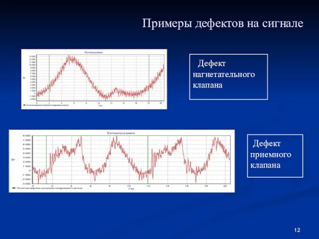 Примеры дефектов на сигнале Дефект приемного клапана Дефект нагнетательного клапана