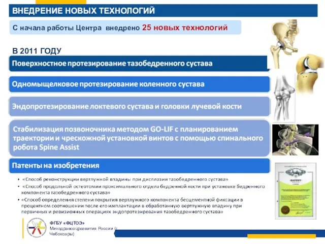 ВНЕДРЕНИЕ НОВЫХ ТЕХНОЛОГИЙ С начала работы Центра внедрено 25 новых технологий В 2011 ГОДУ