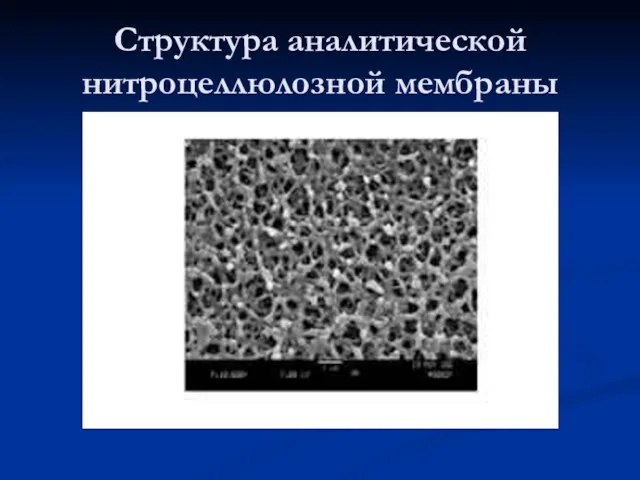 Структура аналитической нитроцеллюлозной мембраны