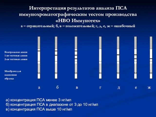 Интерпретация результатов анализа ПСА иммунохроматографическим тестом производства «НВО Иммунотех» a – отрицательный;