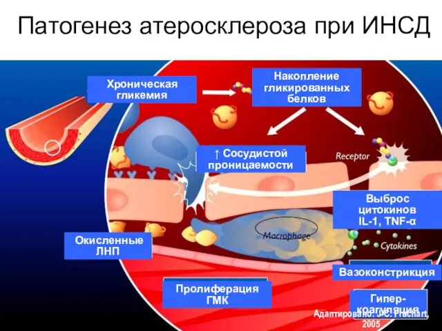 Патогенез атеросклероза при ИНСД Хроническая гликемия Накопление гликированных белков ↑ Сосудистой проницаемости