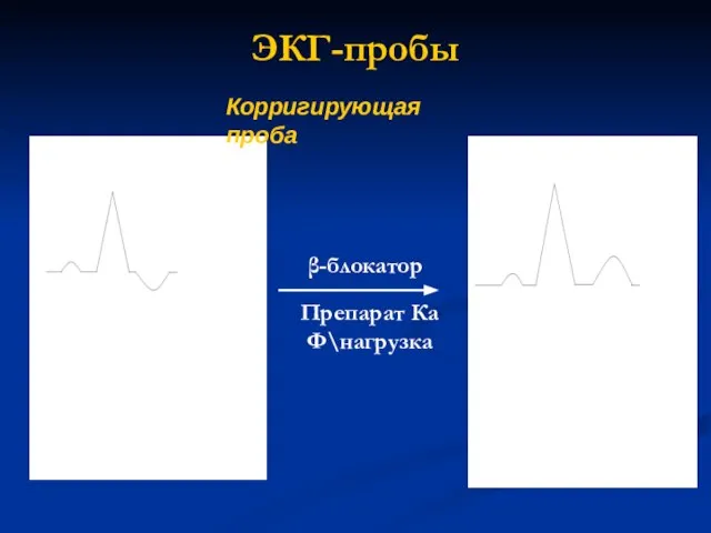 ЭКГ-пробы Корригирующая проба β-блокатор Препарат Ка Ф\нагрузка