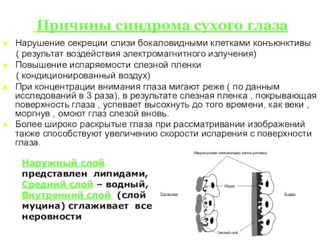 Нарушение секреции слизи бокаловидными клетками конъюнктивы ( результат воздействия электромагнитного излучения) Повышение