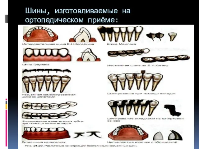 Шины, изготовливаемые на ортопедическом приёме: