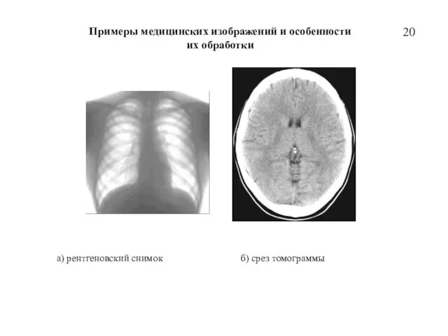 20 Примеры медицинских изображений и особенности их обработки а) рентгеновский снимок б) срез томограммы