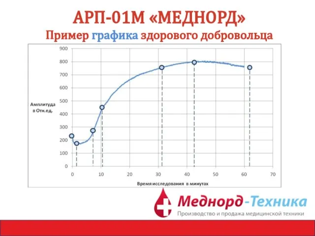 АРП-01М «МЕДНОРД» Пример графика здорового добровольца