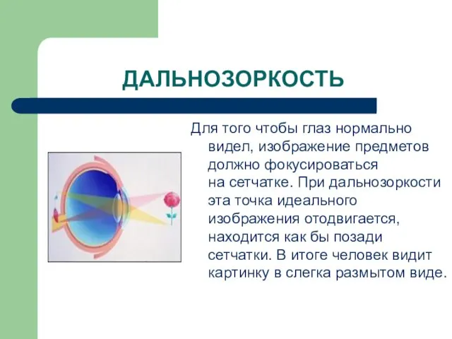 ДАЛЬНОЗОРКОСТЬ Для того чтобы глаз нормально видел, изображение предметов должно фокусироваться на