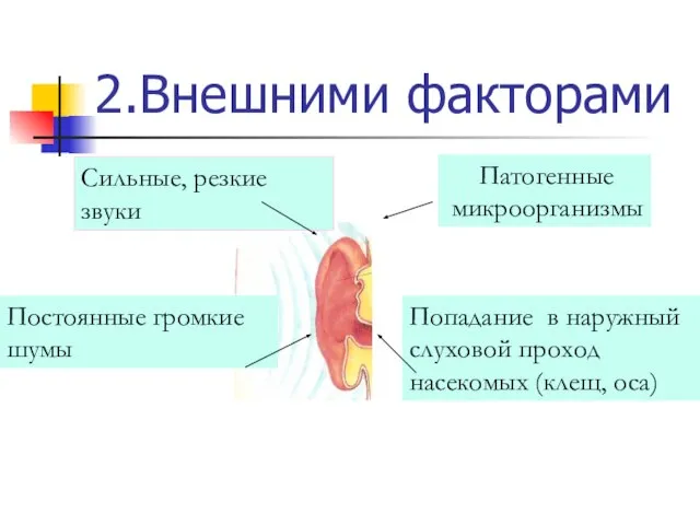 2.Внешними факторами Сильные, резкие звуки Постоянные громкие шумы Патогенные микроорганизмы Попадание в