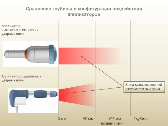 Сравнение глубины и конфигурации воздействия аппликаторов Аппликатор высокоэнергетических ударных волн Аппликатор радиальных