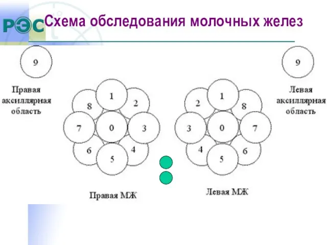 Схема обследования молочных желез